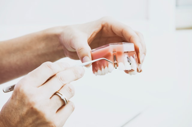dentist holding teeth